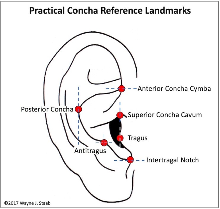 인간 이각(concha, 갑개) 측정