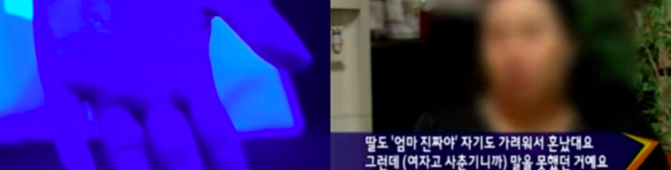  42.형광증백제, 아직도 문제인가?