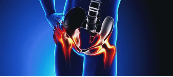 골반이 아파요.골반뼈, 다리쪽 통증까지 획기적인 개선법 7