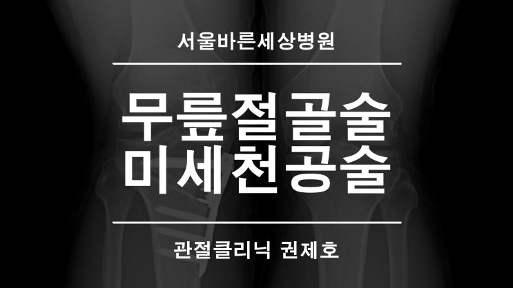 근위경골절골술 미세천공술 휜다리로 인한 원인 치료법