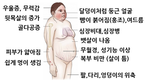부작용 남기는 스테로이드 No …통증 1