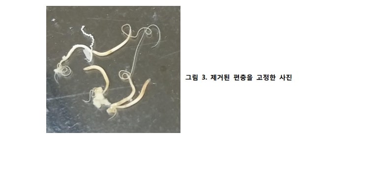 편충, Trichuris trichiura, whipworm(Trichuriasis) : 네이버 블로그
