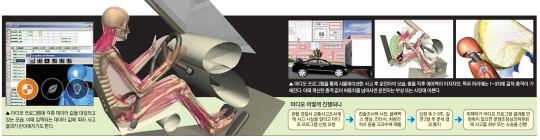 교통사고 ‘나이롱 환자’ 잡는 프로그램, 마디모 아세요? 교통사고 ‘나이롱 환자’ 잡는 프로그램, 마디모 아세요?