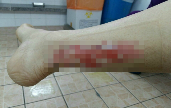 "실비 보험 들었지?" 급식실 산재 쉬쉬하는 학교 "실비 보험 들었지?" 급식실 산재 쉬쉬하는 학교
