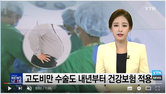고도비만 수술도 내년부터 건강보험 적용 / YTN #곰바이 고도비만 수술도 내년부터 건강보험 적용 / YTN #곰바이