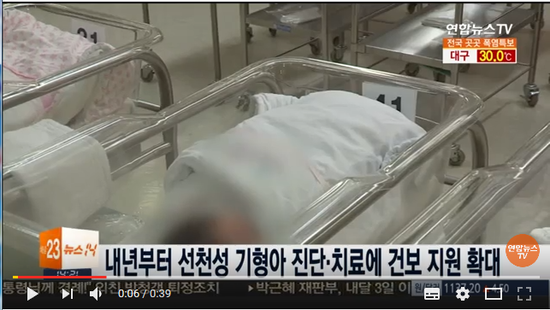 내년부터 선천성 기형아 진단ㆍ치료에 건보 지원 확대 / 연합뉴스TV (YonhapnewsTV)