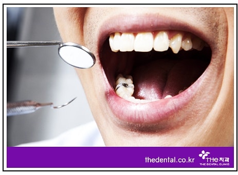 양치질 후에 가글해도 되나요? 12