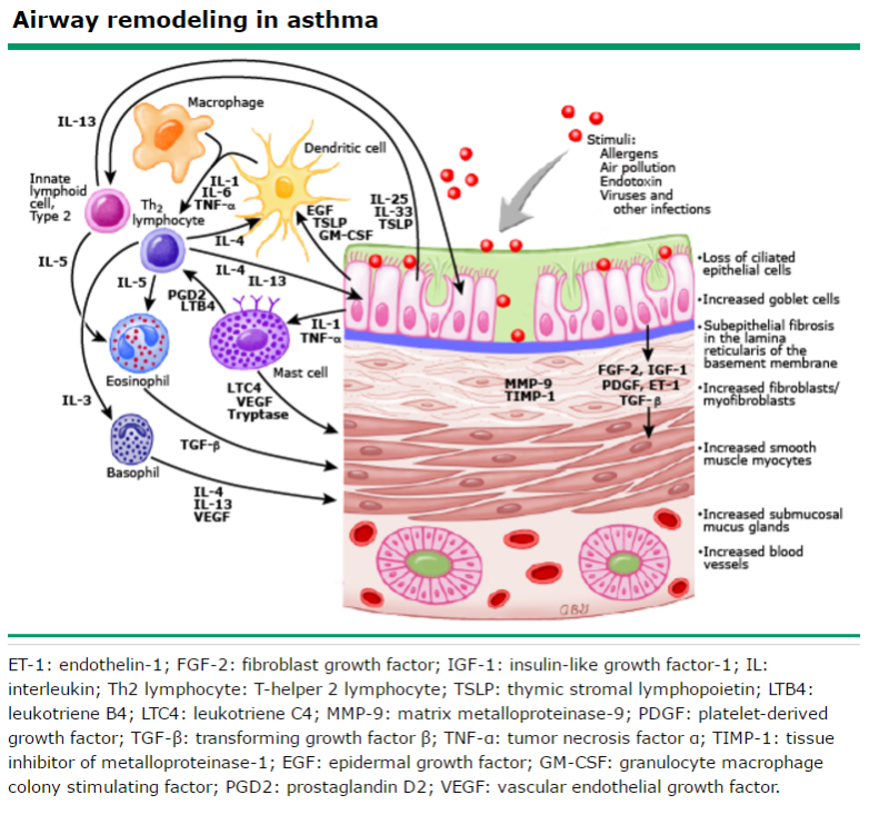 천식에서 기도 개형, Airway remodeling in asthma : 네이버 블로그