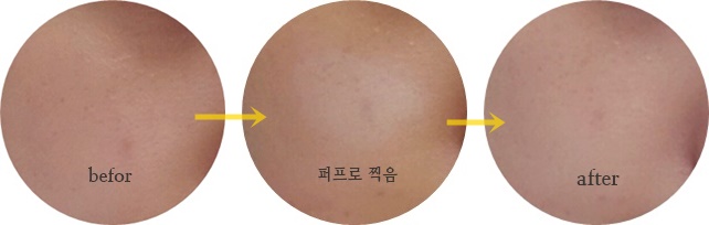  화장 들뜸 없이 선크림을 덧바르자 '앤랩 선쿠션'