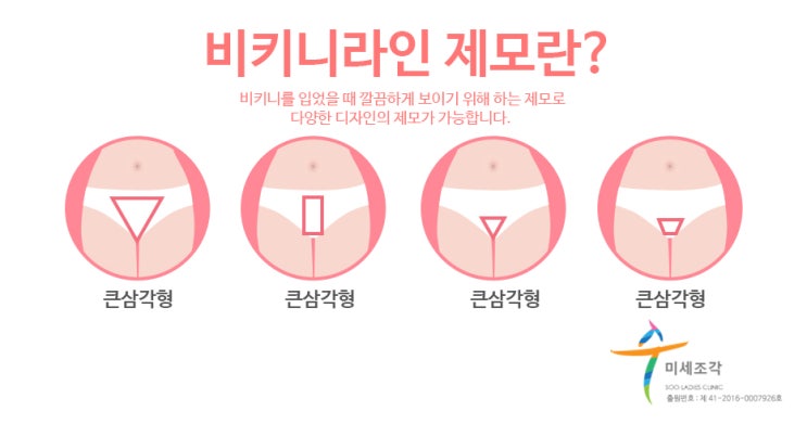 전주비키니라인제모로 당당하게 7