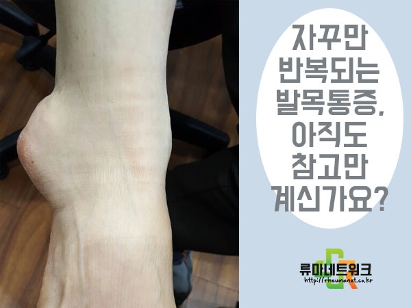 발목이 아플때 이유, 병원