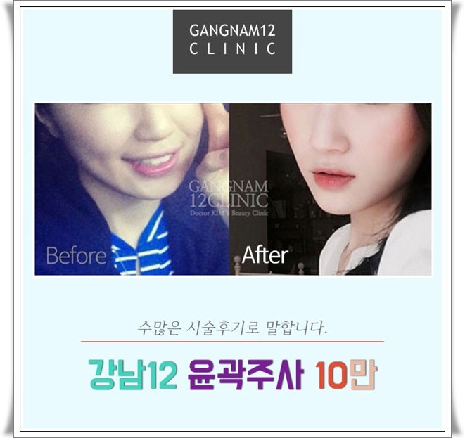 강남 볼살 빼당주사 얼굴살 때문에 8