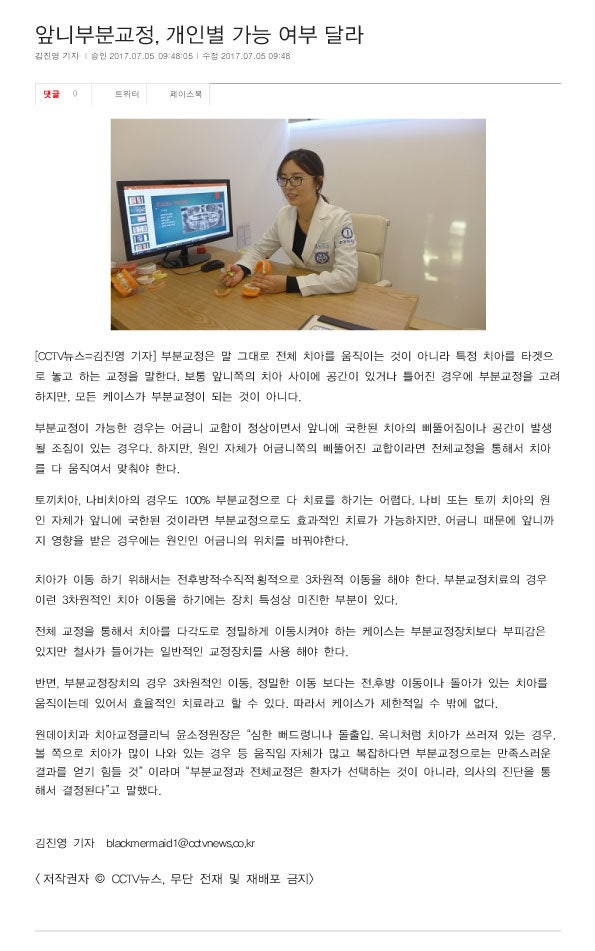 앞니부분교정, 개인별 가능 여부 달라