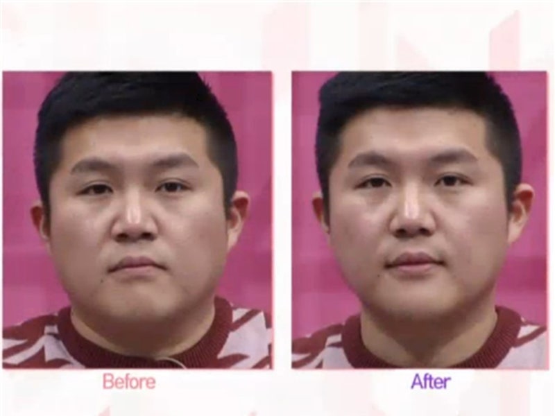 얼굴 작아지는 마사지로 날씬해진 실화