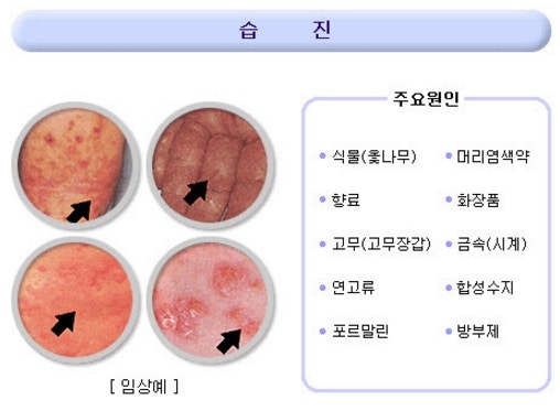 탱자효능 제대로 보려면..