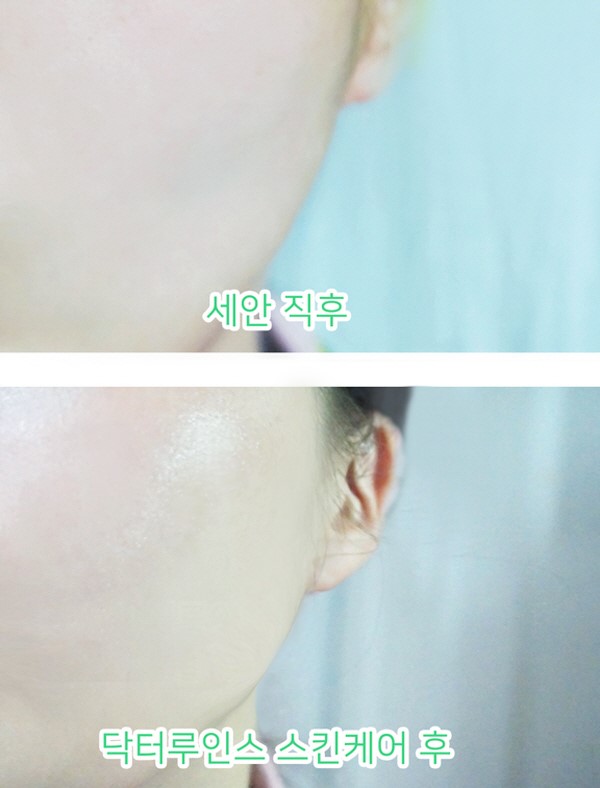  촉촉한 스킨케어 추천 닥터루인스 슈퍼 하이드레이터