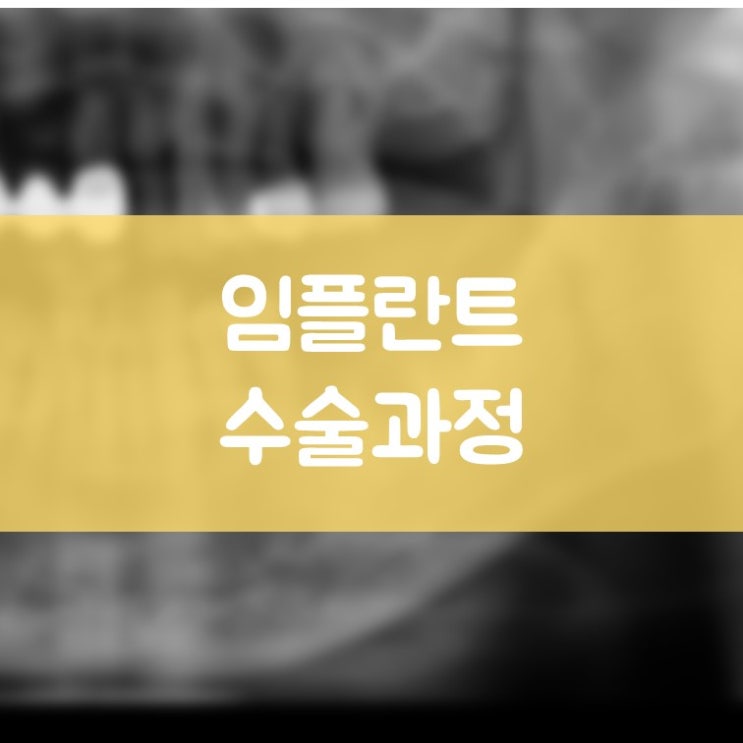 영통구청치과 김기록치과 임플란트 수술은 어떻게 진행되나요?