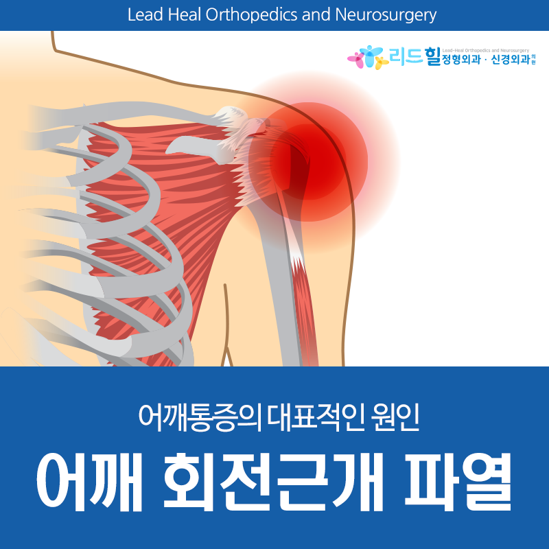 어깨 회전근개 파열 증상의 원인을 살펴보면 8