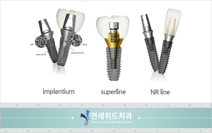 국산 3대회사 임플란트 종류 비교(오스템, 덴티움, 네오). Part 2 : 네이버 블로그 국산 3대회사 임플란트 종류 비교(오스템, 덴티움, 네오). Part 2 : 네이버 블로그