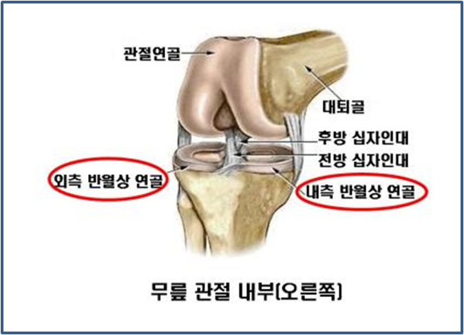 대전무릎병원 반달판 손상의 아픔이 없어도 1