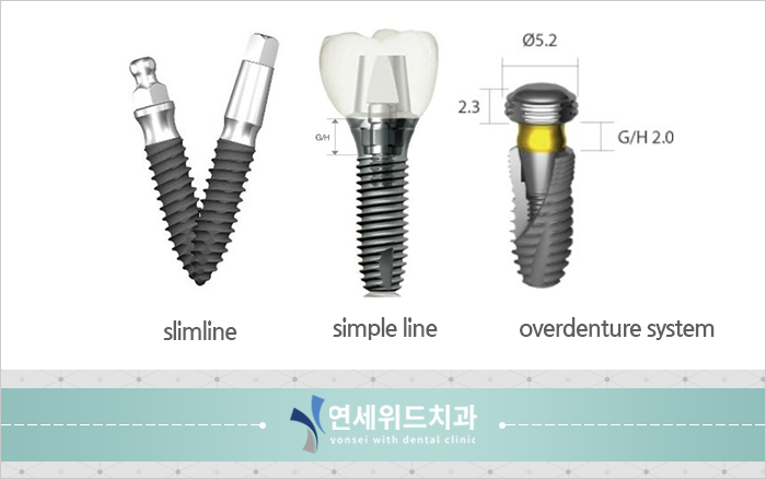 국산 3대회사 임플란트 종류 비교(오스템, 덴티움, 네오). Part 2 : 네이버 블로그 국산 3대회사 임플란트 종류 비교(오스템, 덴티움, 네오). Part 2 : 네이버 블로그