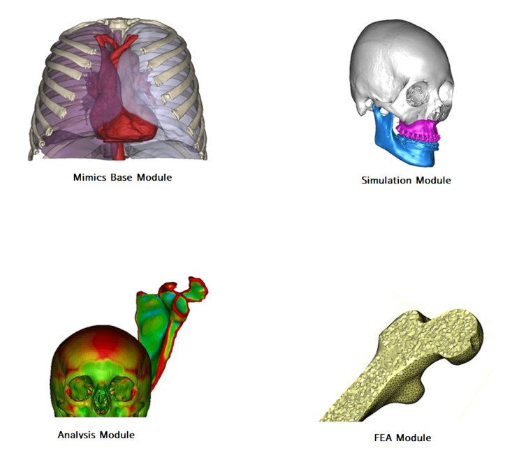  Materialise Mimics의 대표 기능