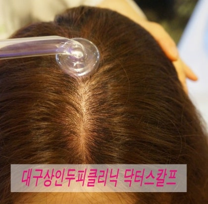 대구두피전문 각질관리 뷰티에스테틱을 다녀왔습니다. 5