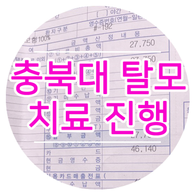  충북대 탈모치료 진행 #윤태영 교수 #여성탈모 #나녹시딜