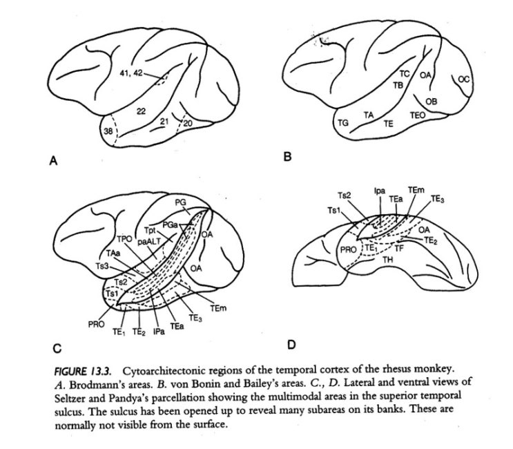  [오연식 박사, 간헐성 외사시, 약시, 난독증, 복시치료] 간헐성 외사시, 약시, 난독증, 복시 치료, 복시 양상, 2017. 08 .07.