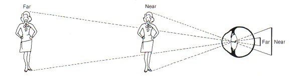  [오연식 박사, 간헐성 외사시, 약시, 난독증, 복시치료] 간헐성 외사시, 약시, 난독증, 복시 치료, 복시 선벌, 2017. 08. 13.