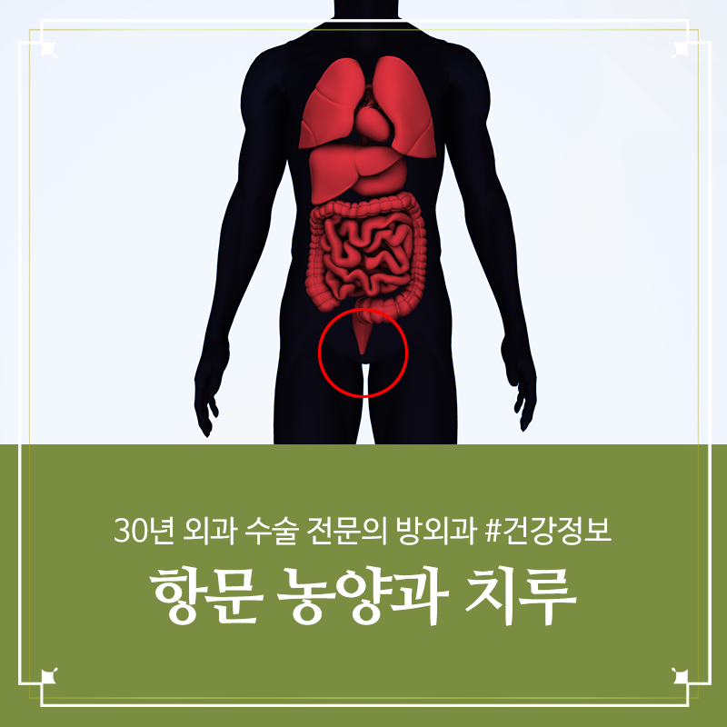 모유 수유와 직장 수술로 인해 항문에서부터 시작되는 불편함은 이제 개선이 필요합니다.