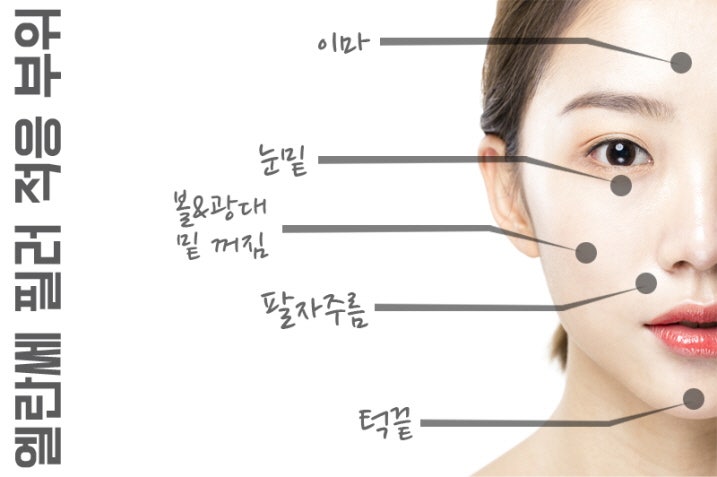 무릎 연골 주사와 줄기세포 주사 치료 효과(효능)가 이렇게 다릅니다.