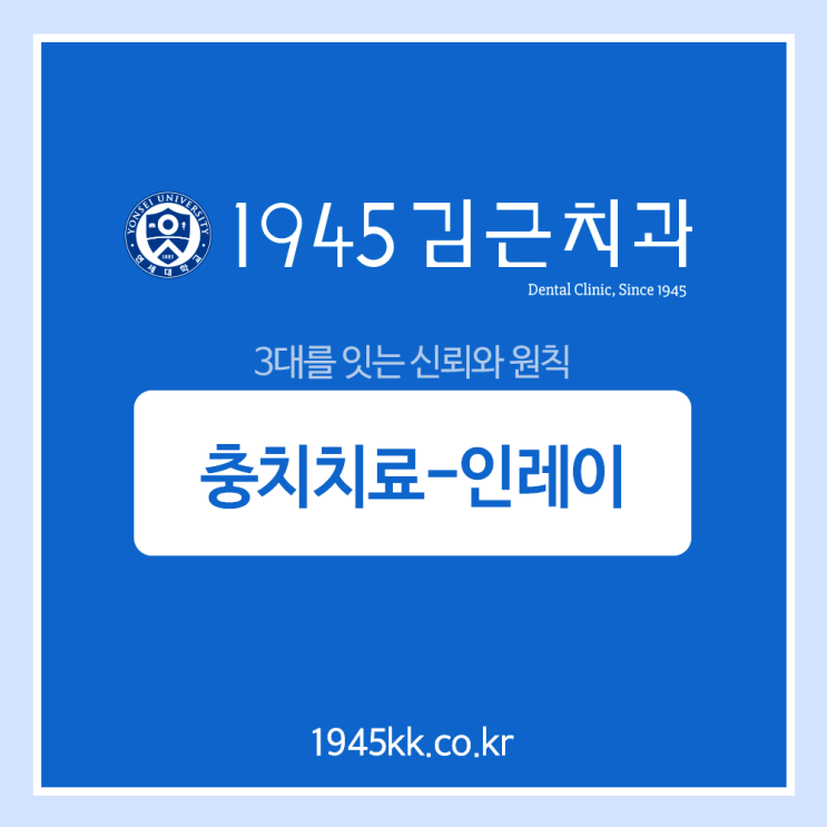  부산충치치료 인레이가궁금해?