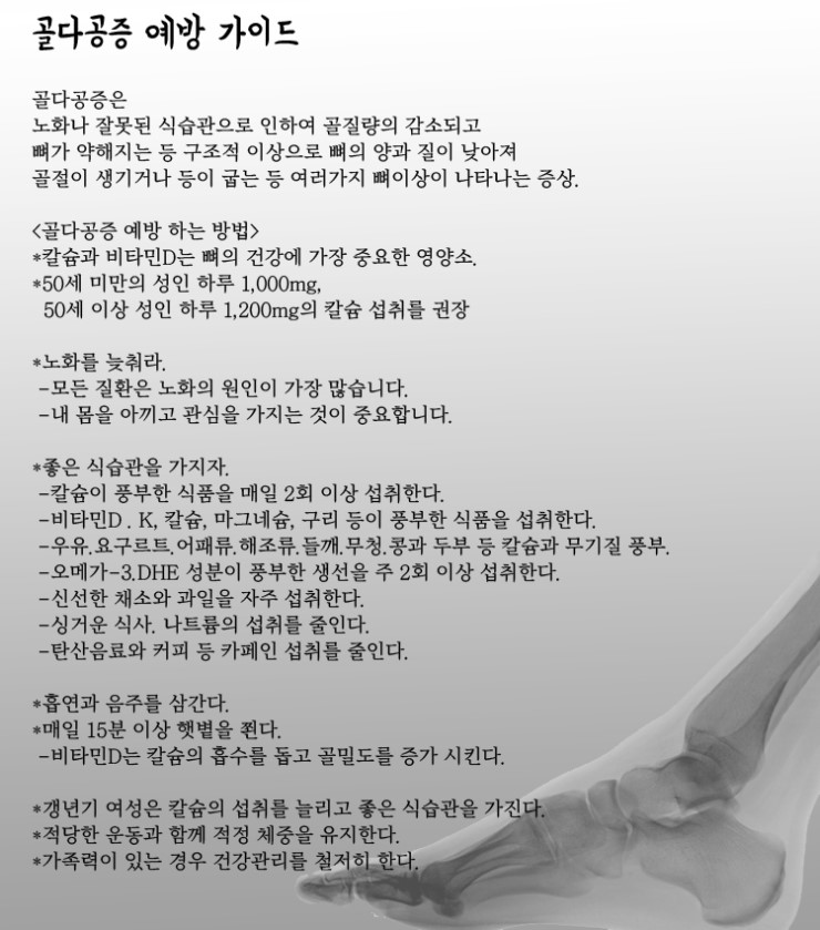  골다공증 예방하는 방법