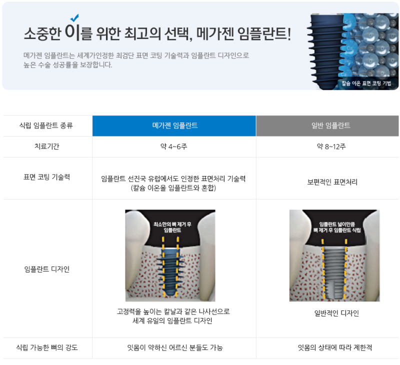 국산 임플란트 종류와 특징(오스템, 덴티움, 디오, 메가젠) : 네이버 블로그 국산 임플란트 종류와 특징(오스템, 덴티움, 디오, 메가젠) : 네이버 블로그