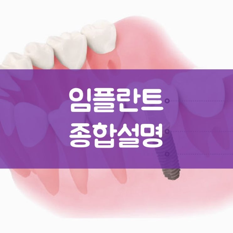 매탄동임플란트 김기록치과 왜 임플란트를 해야 할까요? (오스템임플란트 참조)