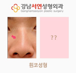 휜코 성형