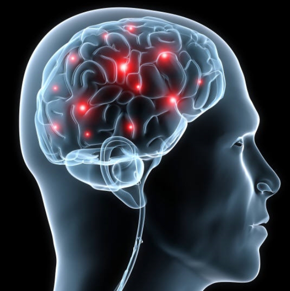  두뇌포뮬라 (Brain Formular)
