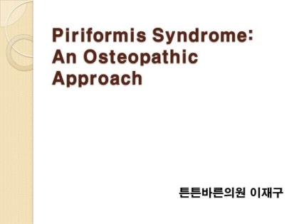Piriformis Syndrome —, Naas Osteopaths