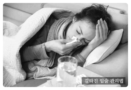  갈라진 입술 관리법