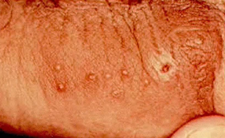 (비뇨기과) 요로결석/전립선염/요도염/매독/음부궤양/방광요관역류/고환 및 음낭질환