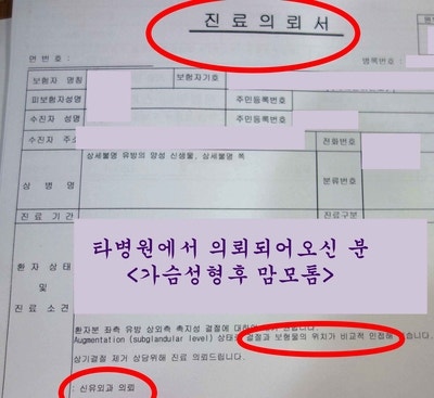 가슴보형물에서 0.8mm떨어진 멍울을 맘모톰으로 안전하게 제거하면서, 재발된 함몰유두 교정수술해 드렸던 분