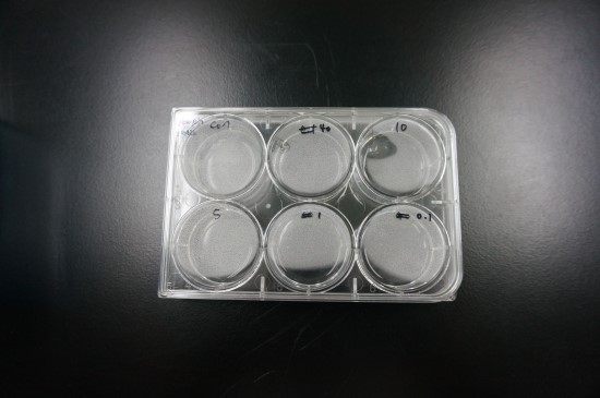  단지 세포 관찰하기 위한 간단한 염색