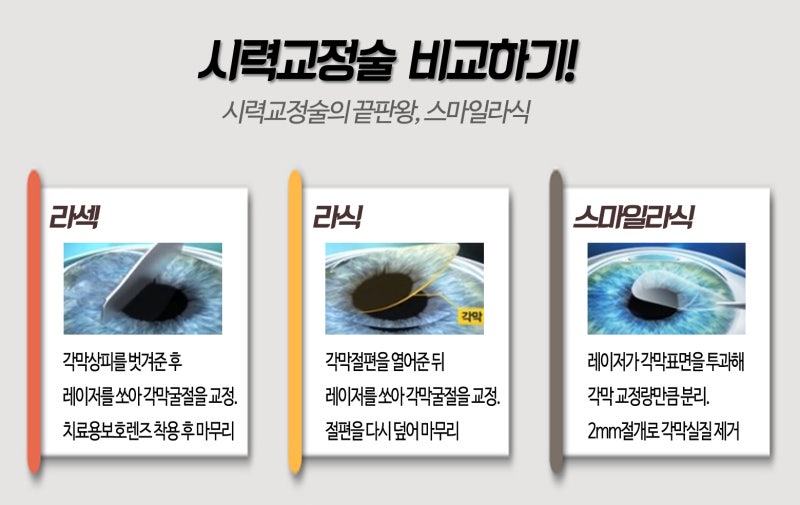 라식의 차이점 추천 시기