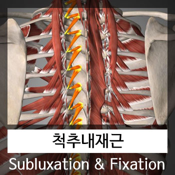 [카이로프랙틱교육]척추내재근과 서브럭세이션(subluxation)&추골고정(fixation)