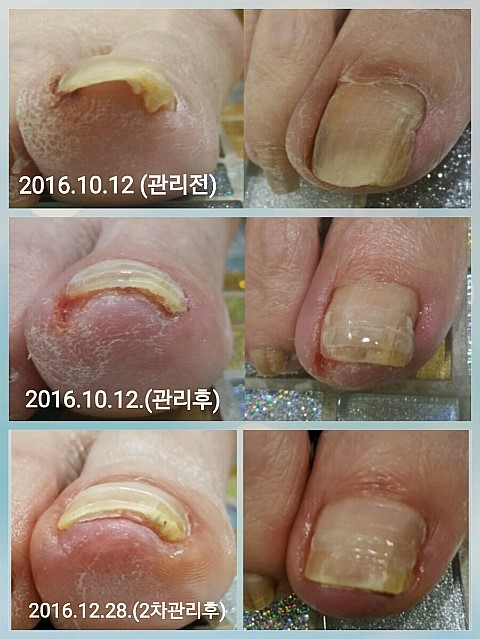 멀리 오창에서~/분당용인수지보정죽전동/주네일