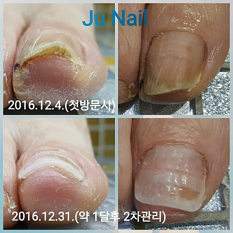 RN로보 견인기/분당용인수지보정죽전동/주네일