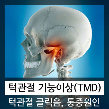 턱관절(TMJ) 장애, 통증, 클릭음, 기능이상의 원인과 교정법