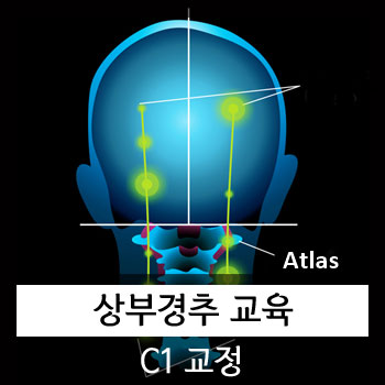  [카이로프랙틱 교육] 상부경추(환추 C1)교정 교육 강의