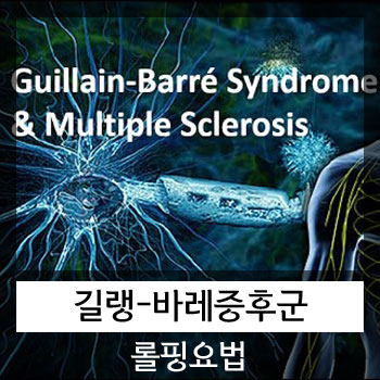  길랭 바레 증후군(길리안 바레 증후군) 후유증 롤핑요법